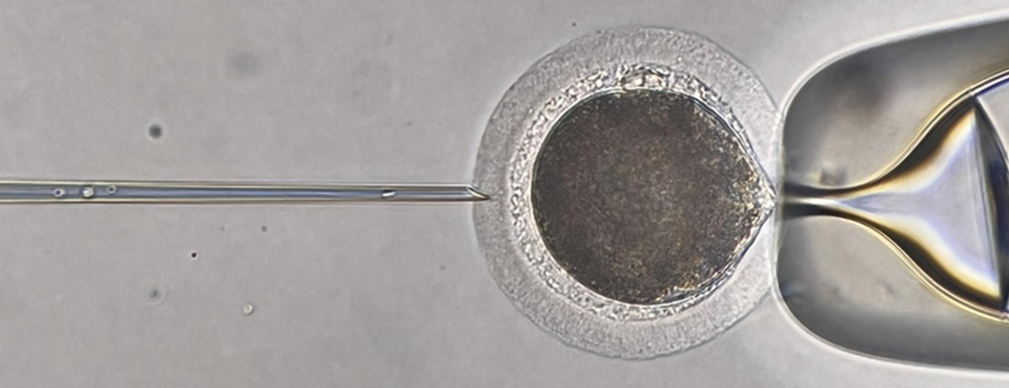 Needle injecting a sperm into an egg under a microscope
